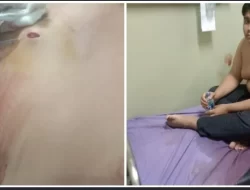 Pemuda Tambun Ditikam Orang Tidak Dikenal