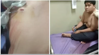 Pemuda Tambun Ditikam Orang Tidak Dikenal